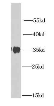 LDHB Rabbit Polyclonal Antibody