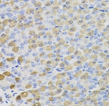 LDHB Rabbit Polyclonal Antibody