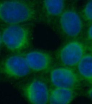 LDLR Rabbit Polyclonal Antibody