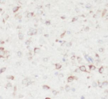 LDLR Rabbit Polyclonal Antibody