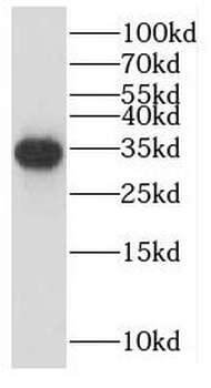 LEFTY2 Rabbit Polyclonal Antibody