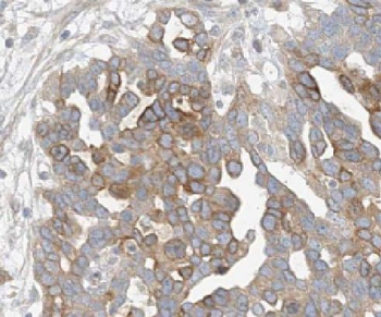 LEFTY2 Rabbit Polyclonal Antibody