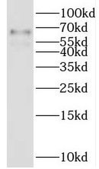 LGI1 Rabbit Polyclonal Antibody