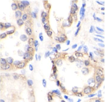 LGI1 Rabbit Polyclonal Antibody