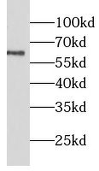 LGI2 Rabbit Polyclonal Antibody