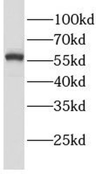 LGI3 Rabbit Polyclonal Antibody