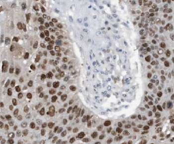 LGI3 Rabbit Polyclonal Antibody