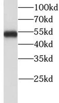 LHX6 Rabbit Polyclonal Antibody