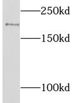LIFR Rabbit Polyclonal Antibody