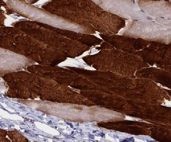LIFR Rabbit Polyclonal Antibody