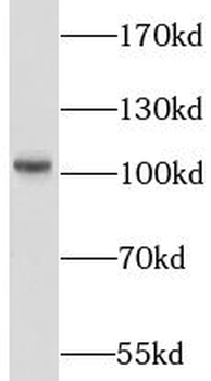 LIG4 Rabbit Polyclonal Antibody