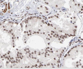 LIG4 Rabbit Polyclonal Antibody