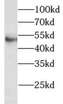 LILRA2 Rabbit Polyclonal Antibody