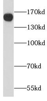 PPFIA1 Rabbit Polyclonal Antibody