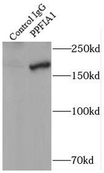 PPFIA1 Rabbit Polyclonal Antibody
