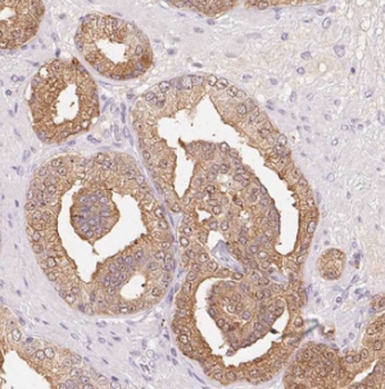 PPFIA1 Rabbit Polyclonal Antibody