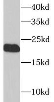 LITAF Rabbit Polyclonal Antibody