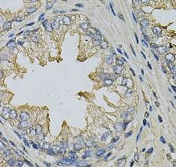 LITAF Rabbit Polyclonal Antibody