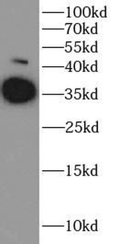 ARG1 Rabbit Polyclonal Antibody