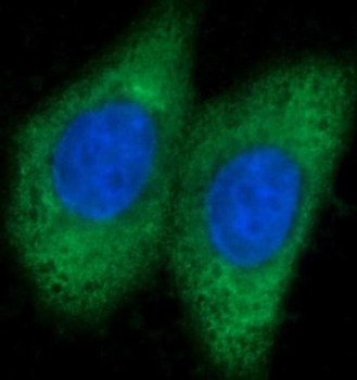 ARG1 Rabbit Polyclonal Antibody
