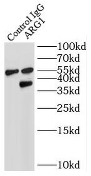 ARG1 Rabbit Polyclonal Antibody
