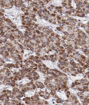 ARG1 Rabbit Polyclonal Antibody