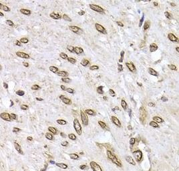 LMNB2 Rabbit Polyclonal Antibody