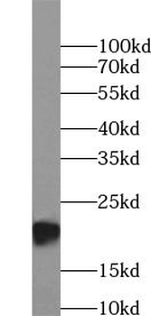 PSMB9 Rabbit Polyclonal Antibody