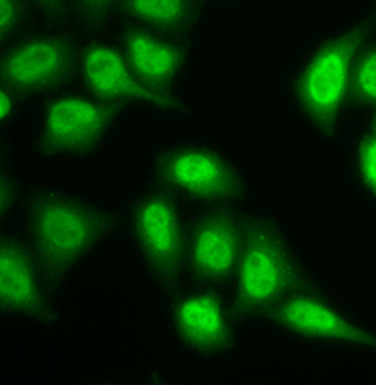 PSMB9 Rabbit Polyclonal Antibody