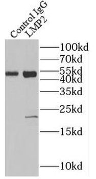 PSMB9 Rabbit Polyclonal Antibody