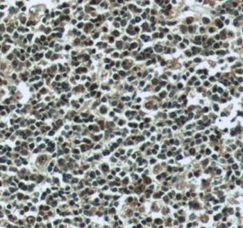 PSMB9 Rabbit Polyclonal Antibody