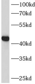 LMX1B Rabbit Polyclonal Antibody