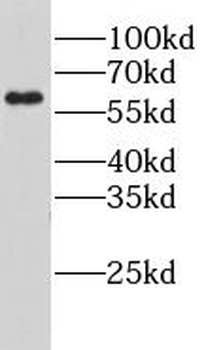 LPCAT1 Rabbit Polyclonal Antibody