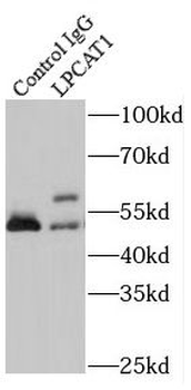 LPCAT1 Rabbit Polyclonal Antibody