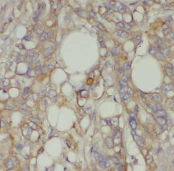 LPCAT1 Rabbit Polyclonal Antibody