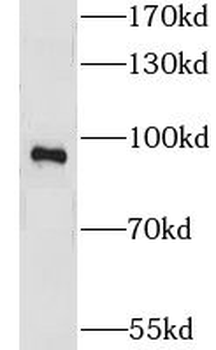 LRCH1 Rabbit Polyclonal Antibody