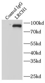 LRCH1 Rabbit Polyclonal Antibody