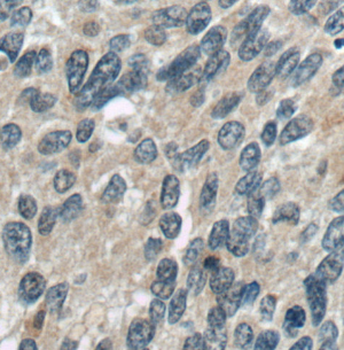LRCH1 Rabbit Polyclonal Antibody