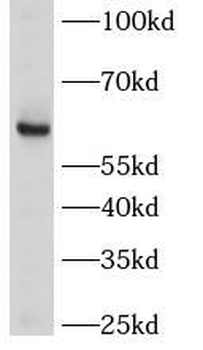 LRRTM2 Rabbit Polyclonal Antibody