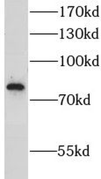 LRSAM1 Rabbit Polyclonal Antibody