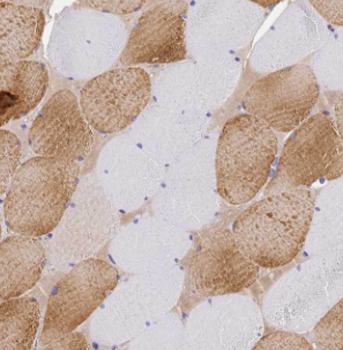 LRSAM1 Rabbit Polyclonal Antibody