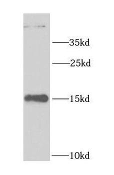 LSM4 Rabbit Polyclonal Antibody