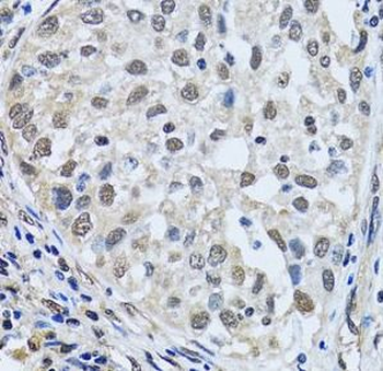 LSM4 Rabbit Polyclonal Antibody