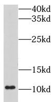 LSM5 Rabbit Polyclonal Antibody