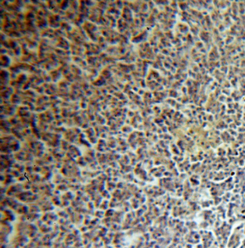 LSM7 Rabbit Polyclonal Antibody