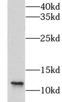 LSM8 Rabbit Polyclonal Antibody