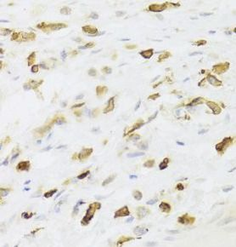LSP1 Rabbit Polyclonal Antibody
