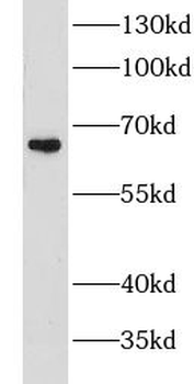 LTA4H Rabbit Polyclonal Antibody