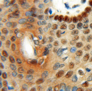 LTA4H Rabbit Polyclonal Antibody