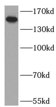 LTBP1 Rabbit Polyclonal Antibody